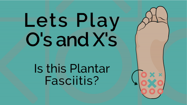 Training Through Heel Pain: Plantar Fasciopathy