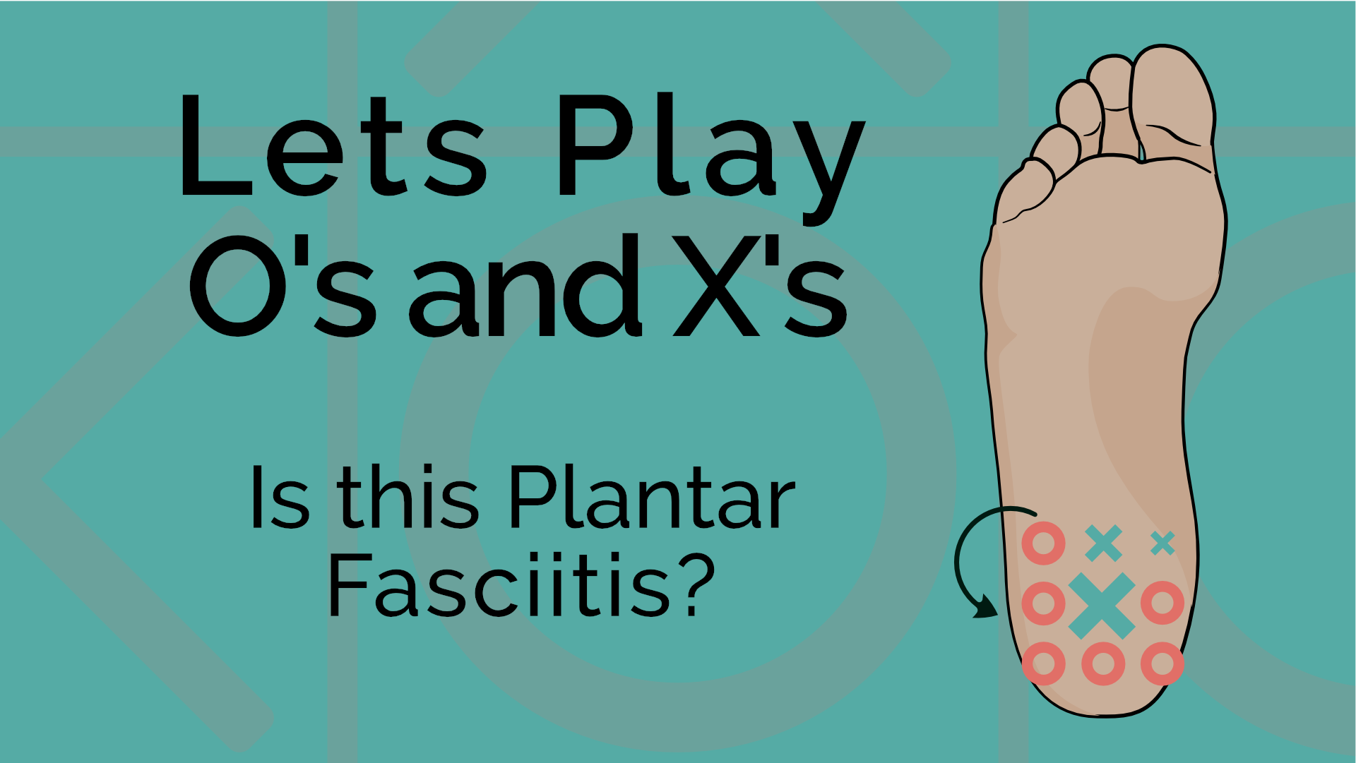 Everyone with Heel Pain Does Not Have Plantar Fasciopathy - Just ask Mr.  Baxter - Physio Network