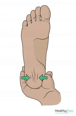 Plantar Fat Pad Atrophy – Perform Podiatry