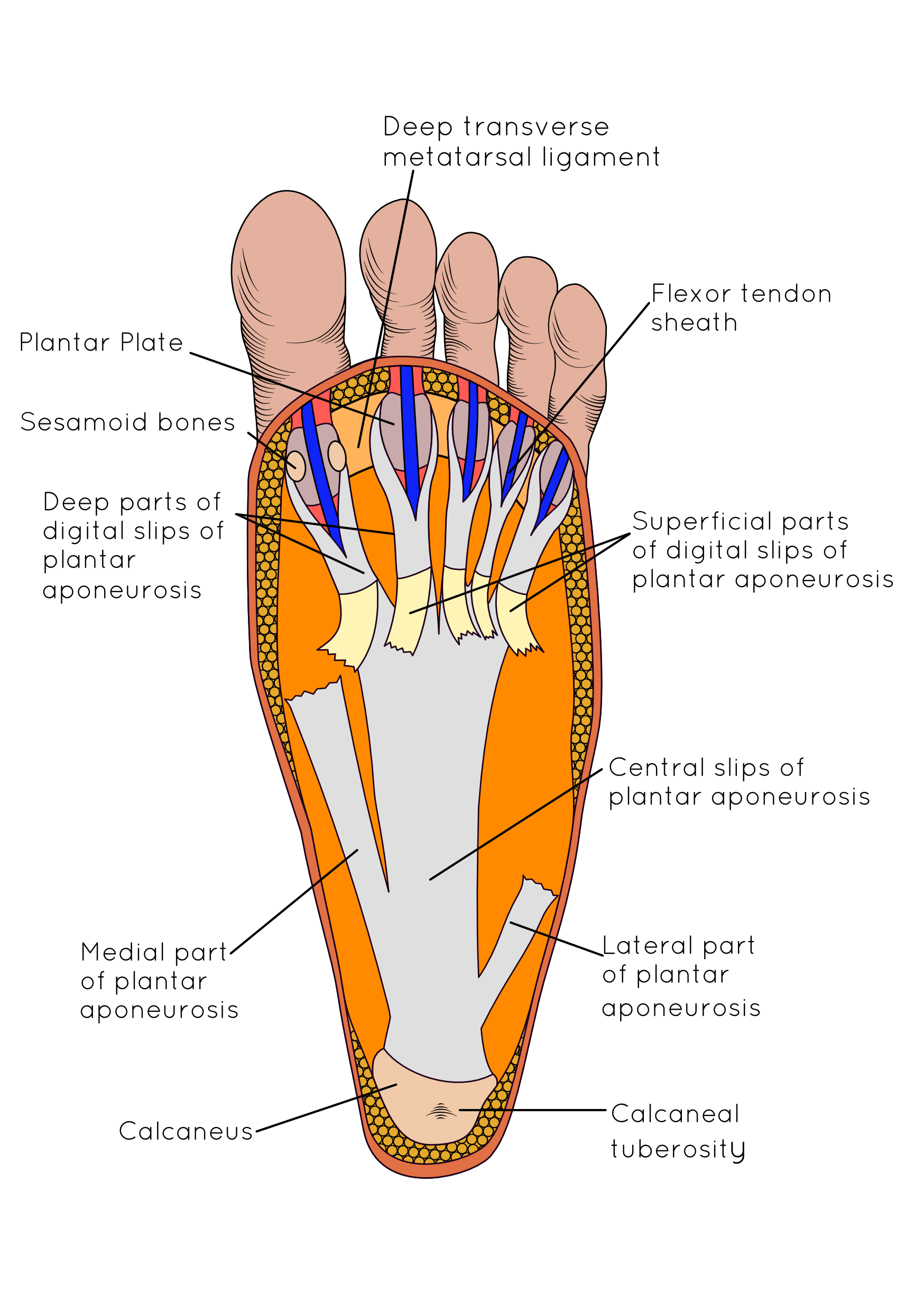 PLANTAR FASCIITIS IN RUNNERS A PAIN IN THE HEEL! Insoles and