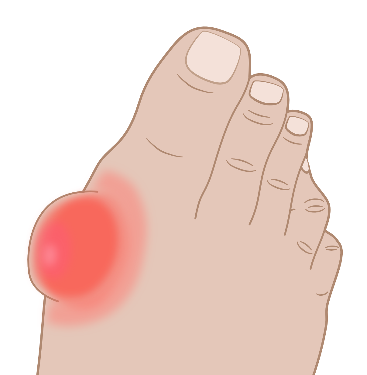 Golf shoes sales for bunions