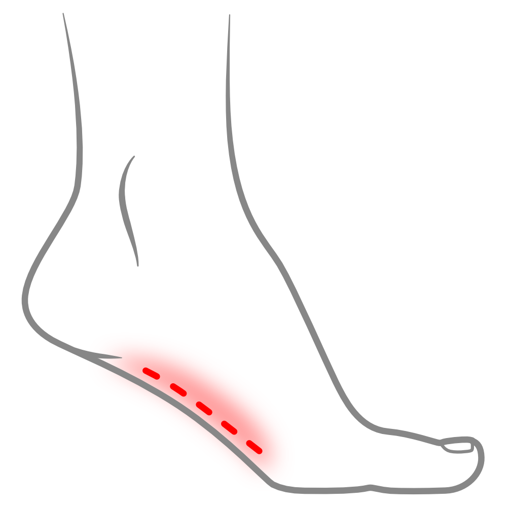 Insoles and Orthotics - Healthy Step