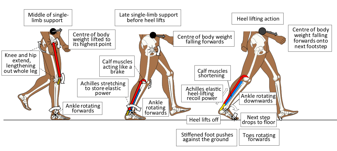 FLAT FEET FALLEN ARCHES AND PRONATED FEET Insoles and Orthotics Healthy Step